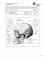 image du crâne pour évaluation des séquelles 1996-09-25